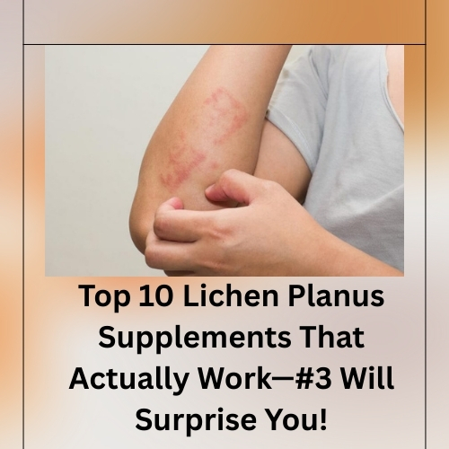 Top 10 Lichen Planus Supplements That Actually Work—#3 Will Surprise You! - Natural Herbs Clinic Blog