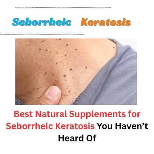 Best Natural Supplements for Seborrheic Keratosis You Haven’t Heard Of - Herbs Solutions By Nature Blog